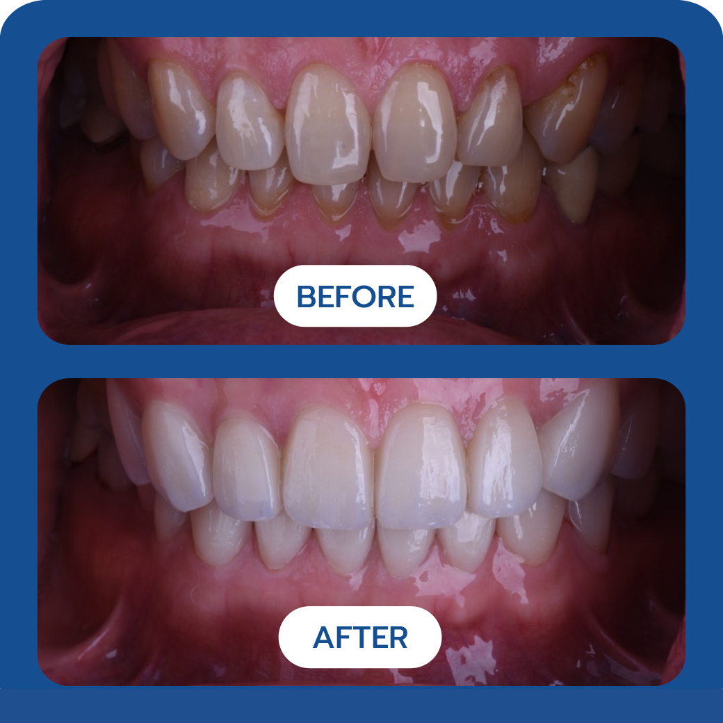 Before and After Case 2